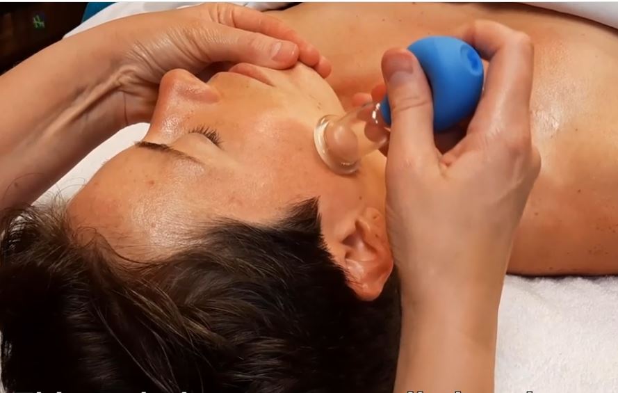 facial cupping cheek